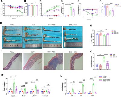 Low-dose ganciclovir ameliorates dextran sulfate sodium-induced ulcerative colitis through inhibiting macrophage STING activation in mice